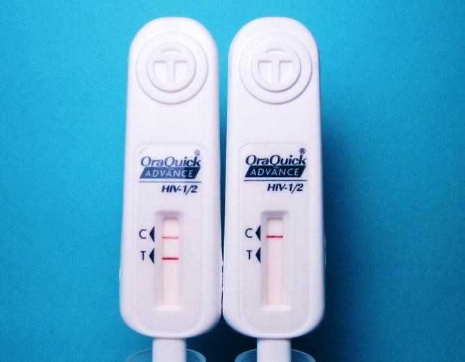 HIV antibody and antigen testing - HIV Management Guidelines