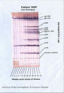 elisa and western blot test for hiv clinic locations