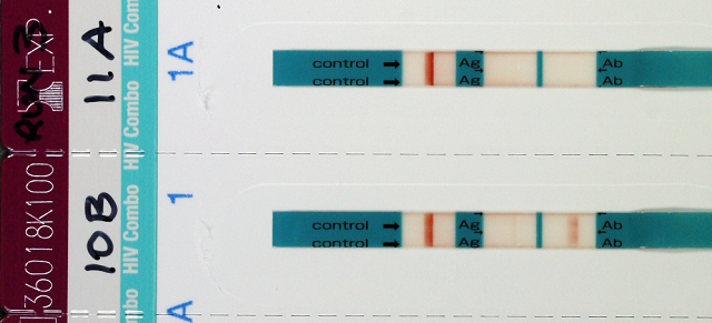 Hiv Antibody And Antigen Testing Hiv Management Guidelines